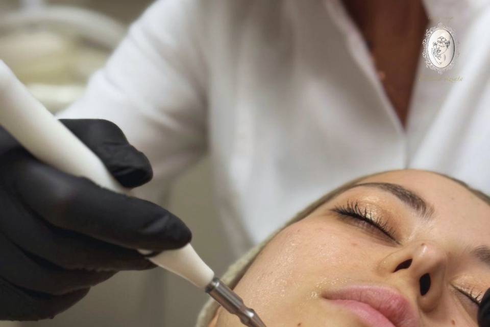 Trattamento contro acne