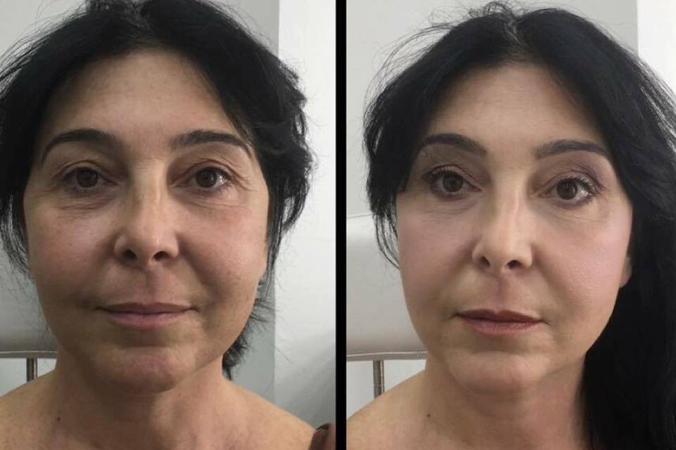 Trucco over 40