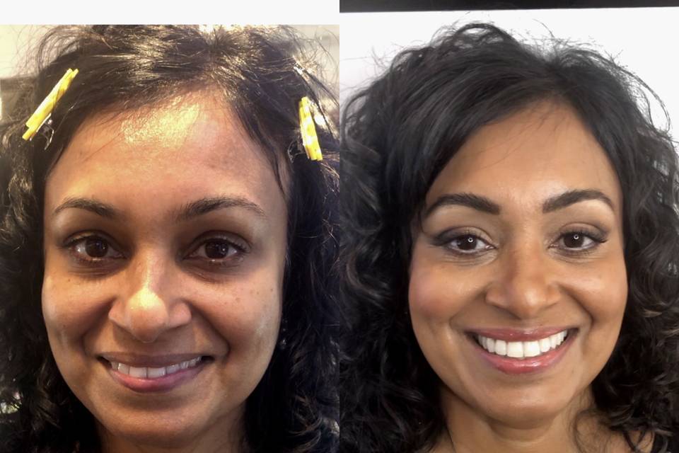 Before and after