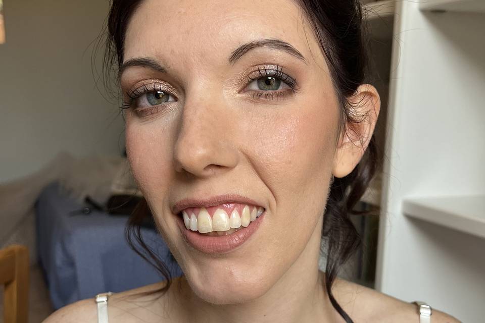 Vittoria Fuser