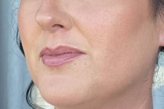Trucco