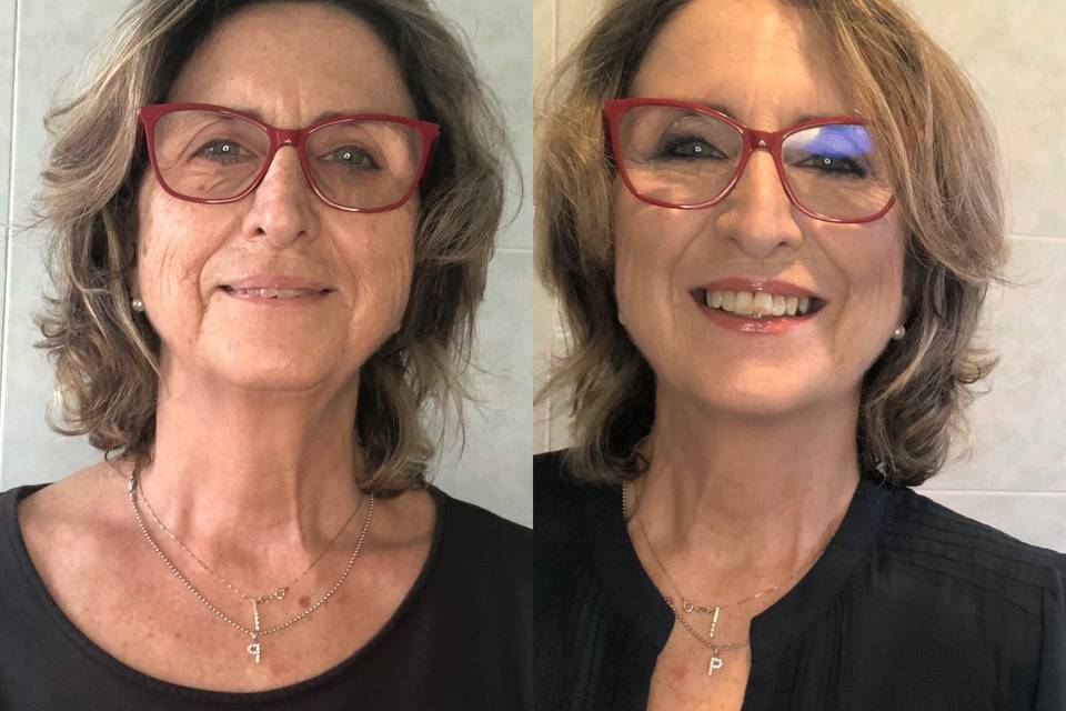 My mum. Before & after
