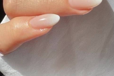 Ricostruzione o gel