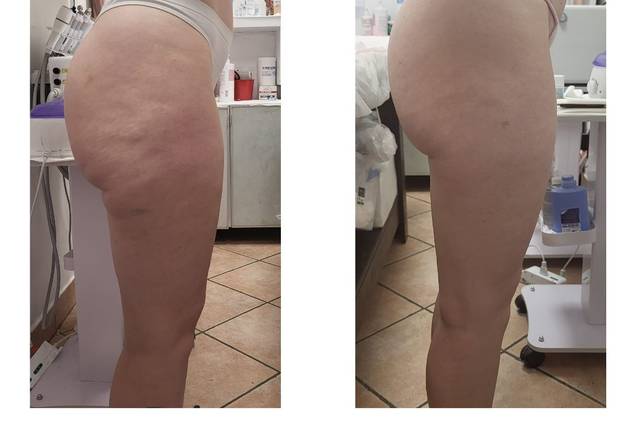 Rimodella 2.0