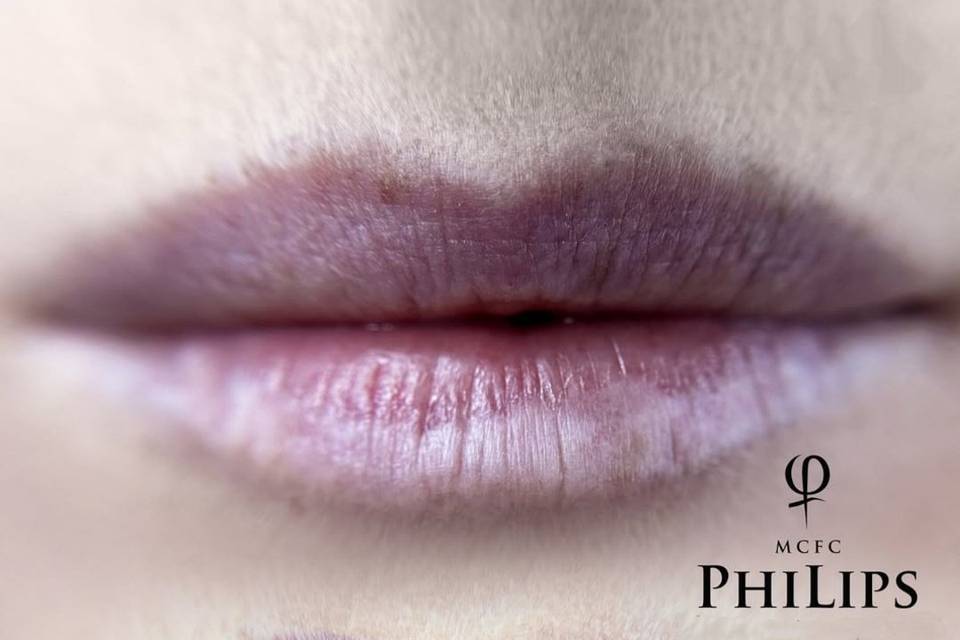 Trucco permanente labbra