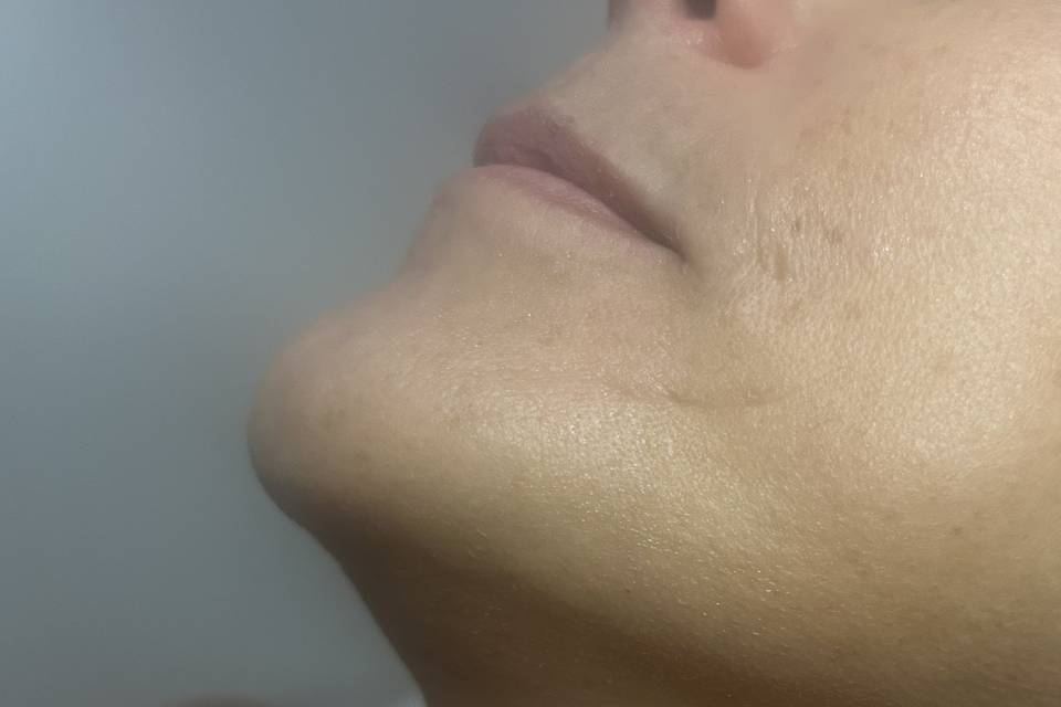 Dopo